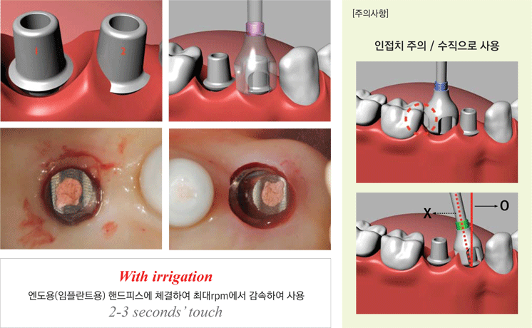 사용방법 이미지